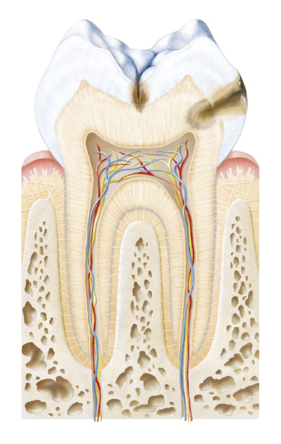 Zubni kaz